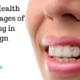 5 Oral Health Advantages of Investing in Invisalign Braces