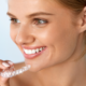 invisalign top and bottom teeth only and cost blog post image of woman smiling
